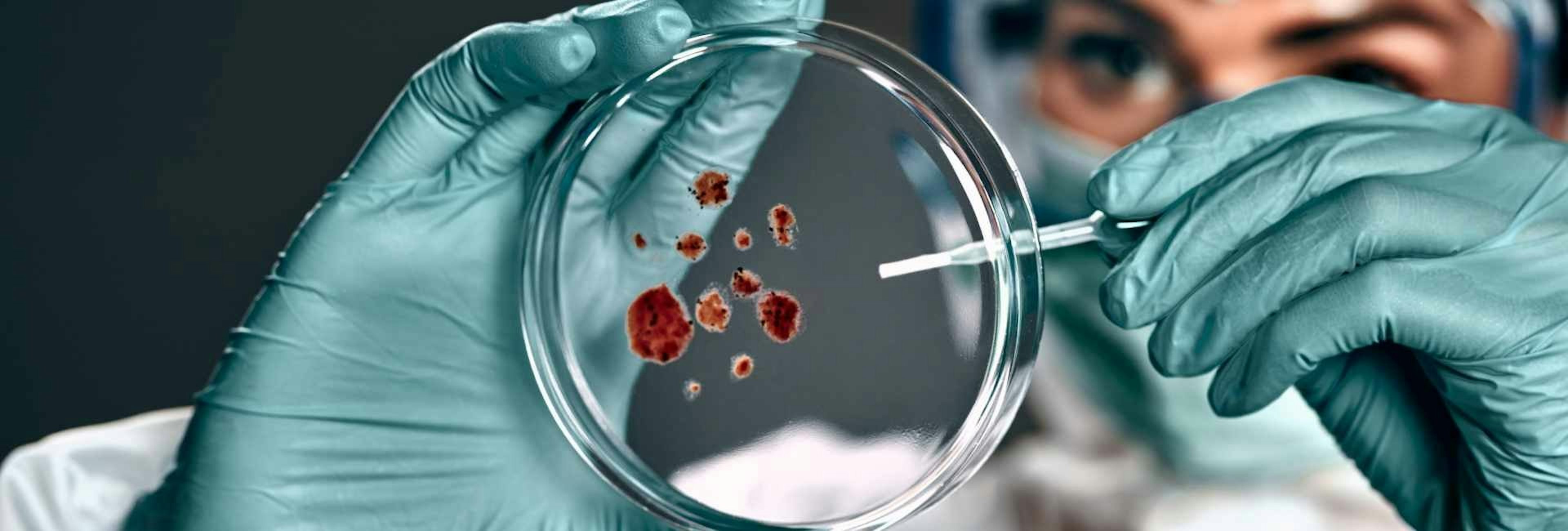Scientist examining a petri dish with biomaterials
